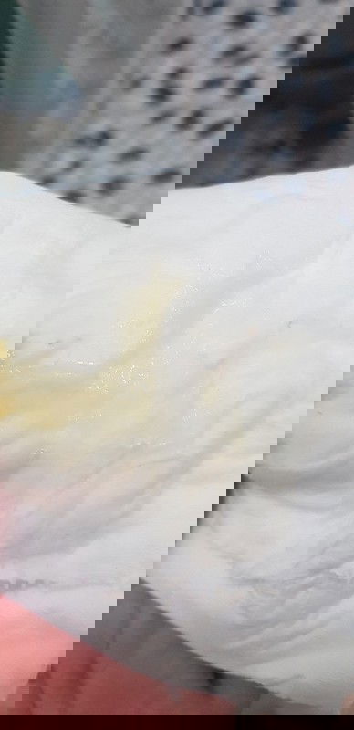 Bé dc 38w4d, ság dạy ra dịch như thế này là sắp sinh đúng k các mom🤔