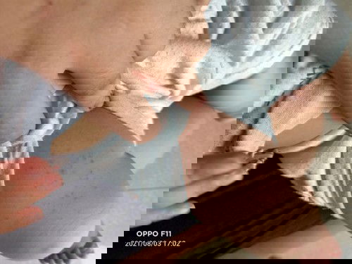 Các m ơi con e bị như vậy tắm là gì cho khỏi ạ