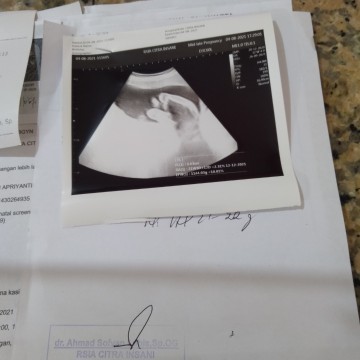 USG di kehamilan 22week