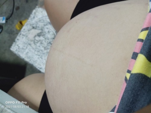 40 wk.1d.ยังไม่ปวดเลยจร้าาา แม่ท่านไหนเปนมั่งคะ อยากคลอดแล้ว