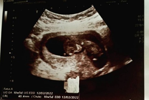 อยากรู้ค่ะ