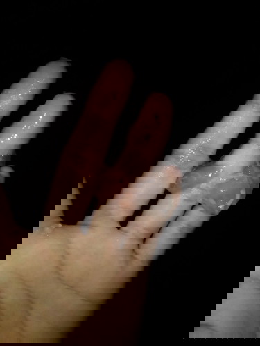 ปวดท้อง+มีมูก