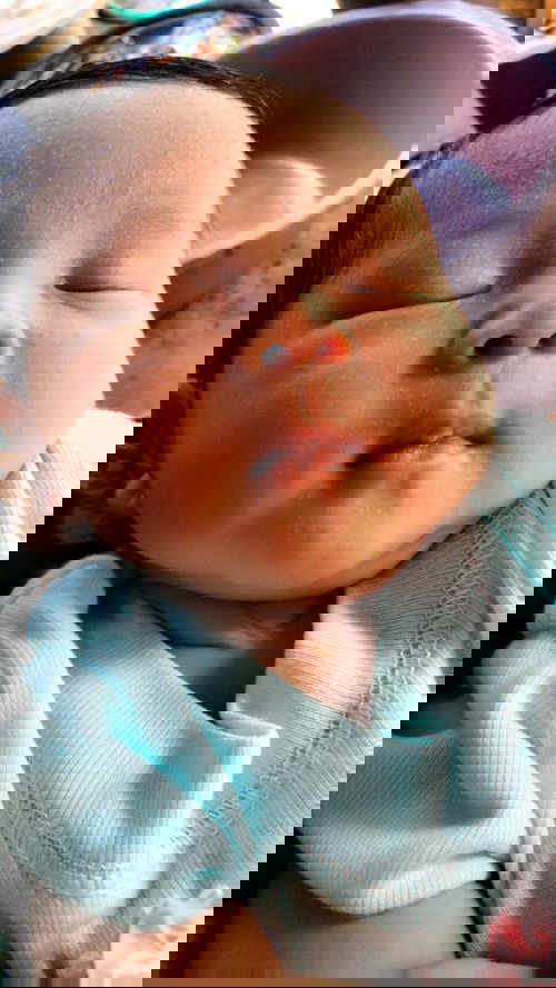 Bintik2 di wajah bayi