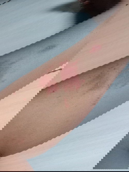 Sekedar sherring Bun,adakah bumil² yg punya pengalaman yang sama dg saya,saya hamil 28 week,dari mul