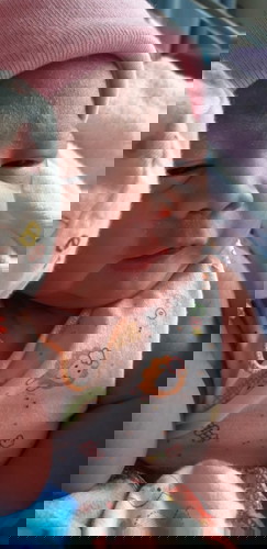 น้องดิวมารายงานตัวครับ
คลอด35+5 น้ำหนัก2,580
แข็งแรงดีค่ะ