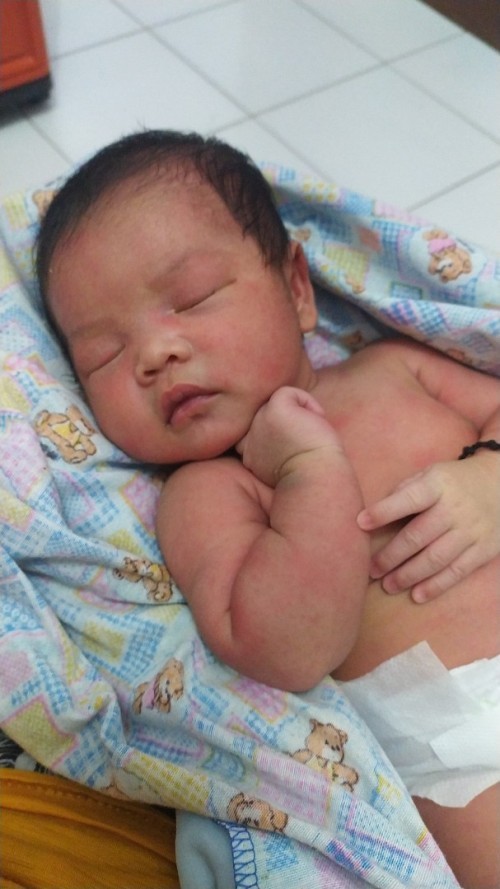 Bintik" Merah pada kulit bayi