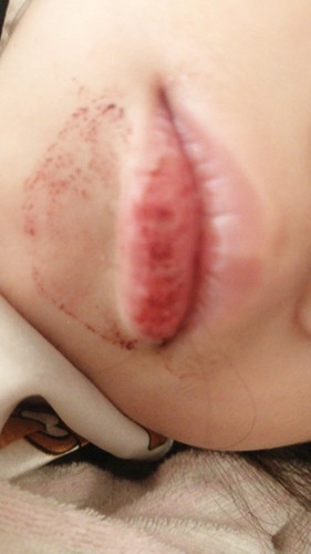 Anak suka kopek bibir