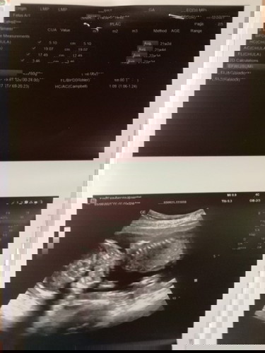 5 เดือนแล้วค่ะ