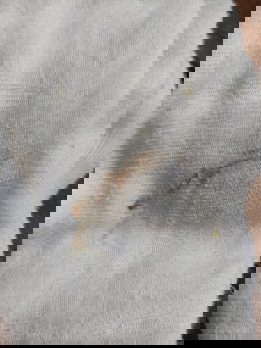 Brownish vomit