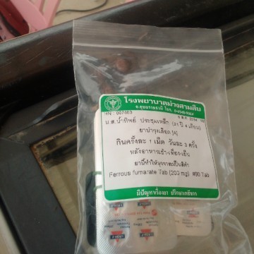 ปวดท้องน่วงๆ