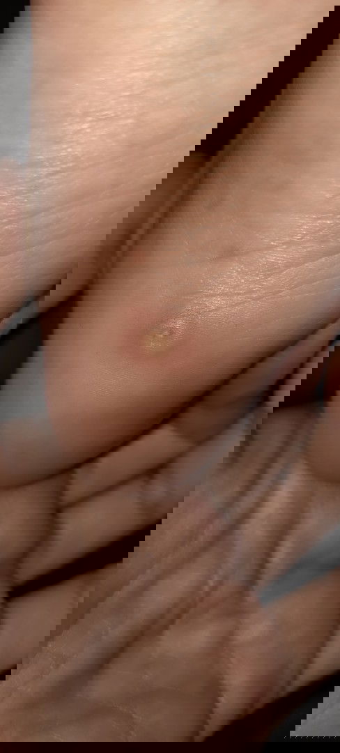 ini mata ikan bukan ya