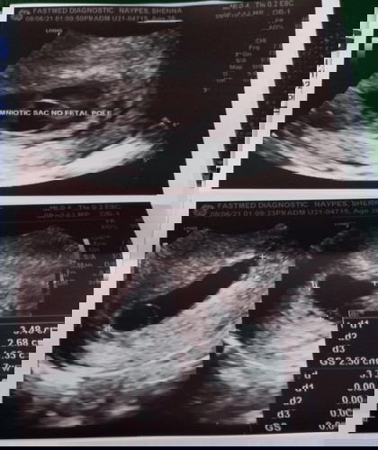 Anu pong dapat kong gawin?