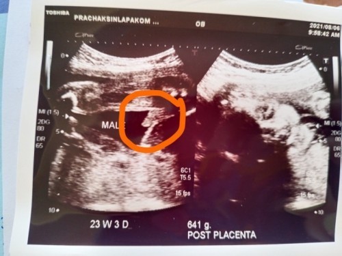 แม่บ้านนี้5เดือนแล้ว