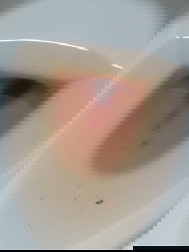 Miscarriage or Period