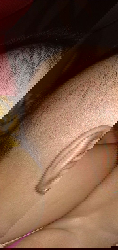 kulit kepalabayi merah merah