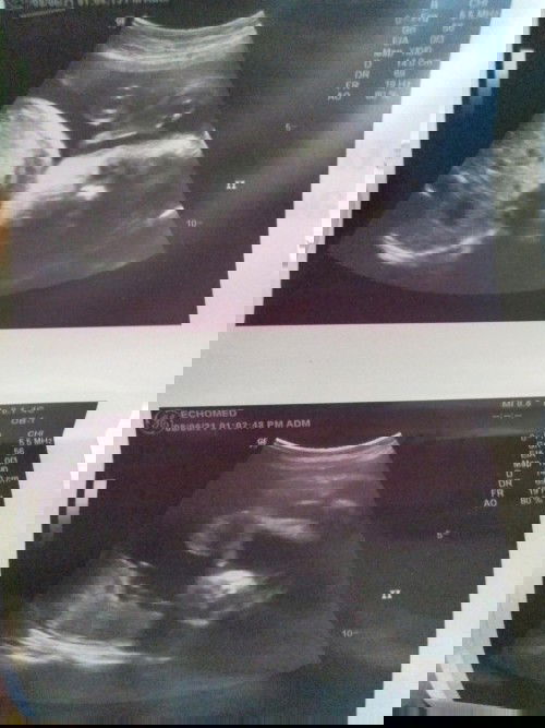 IT'S A BOY! 😍👼