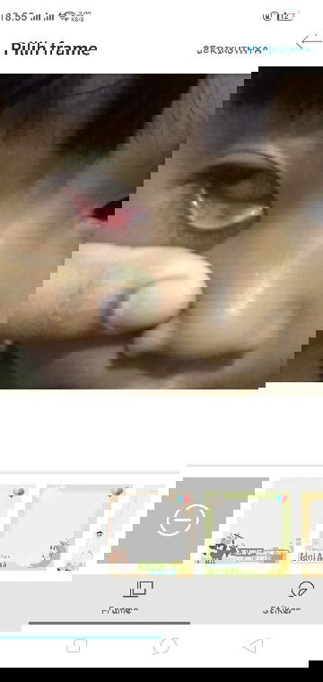 kelopak mata bawah merah dekat kelenjar air mata merah dan bngkak