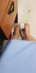 28+4 #เท้าบวมมากๆ