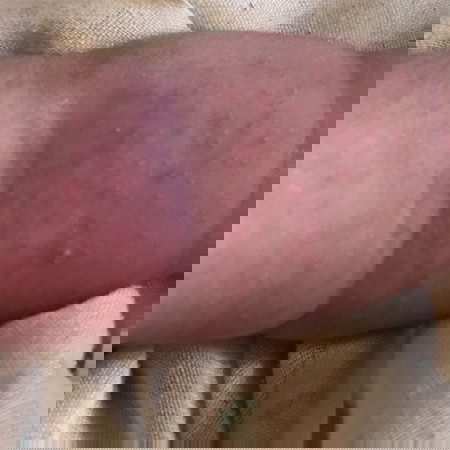 ขอคำแนะนำแม่ๆคะ