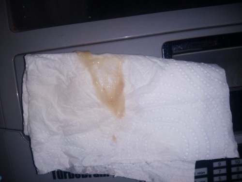 สอบถามถ้ามีมูกแบบนี้ เป็นสัญญาณใกล้คลอดหรือเปล่าคะ