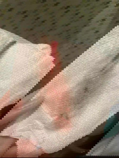 หมอเพิ่งกระตุ้นให้ครั้งแรก