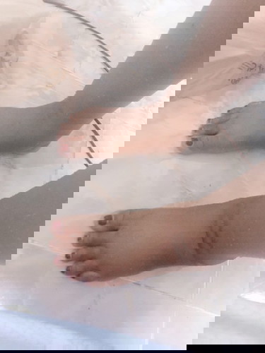 แม่ๆพอมีวิธีลดเท้าบวมไหมคะ