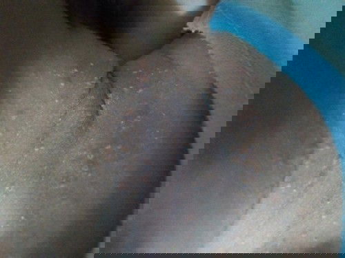 Bé nhà e bị này nè hông BT có s hông ai BT cách gì trị k chỉ e với