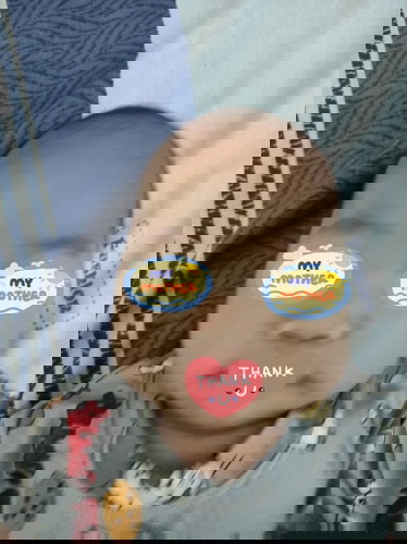 Normal po ba to na ulo ni baby? 3months po.