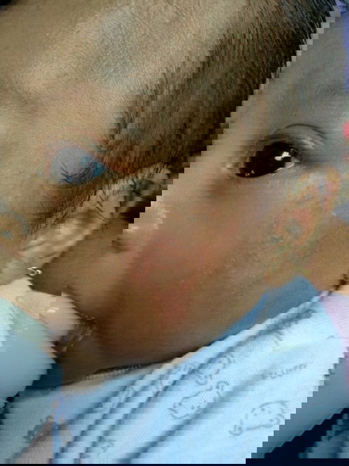 Kesehatan kulit bayi