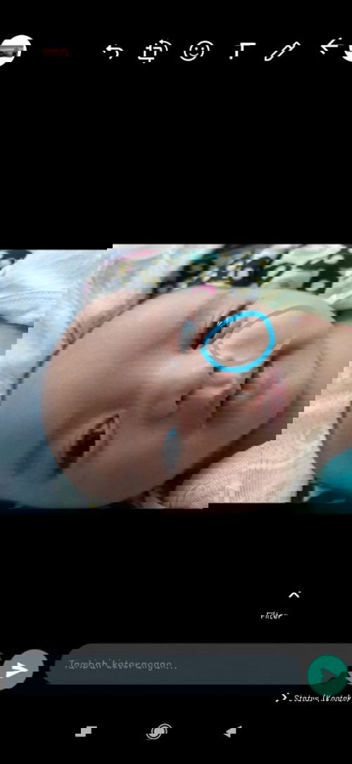 Hilangin bulatan hitam di pipi seperti tompel ( tanda lahir)