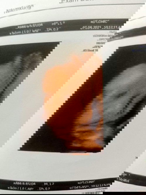 มีแม่ๆบ้านไหนเสี่ยงครรภ์เป็นพิษบ้างค่ะแม่บ้านนี้เสี่ยงค่ะ แล้วมีวิธีอะไรบ้างไม่ให้เรากังวลบ้างค่ะ เพราะตอนนี้กังวลไปตอน  30วีคแล้วค่ะ