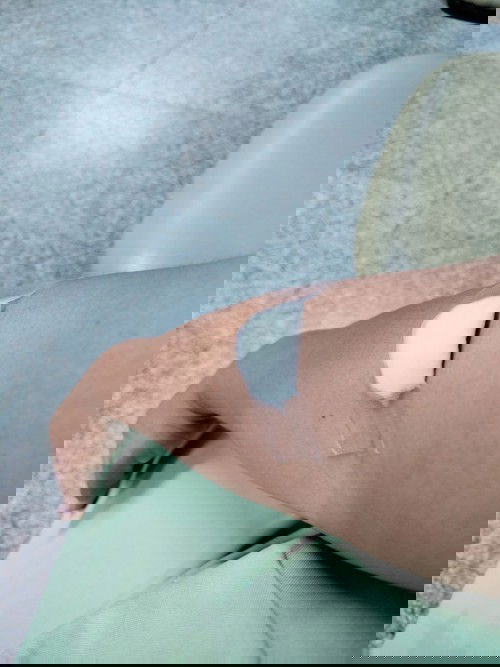 ท้อง 8 เดือนเลือดจาง