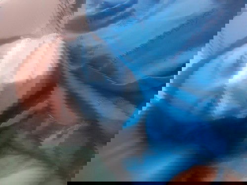 มาแชร์ประสบการค่ะ34+5