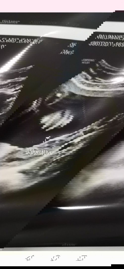 Done CAS, Normal lahat! 🙏😁