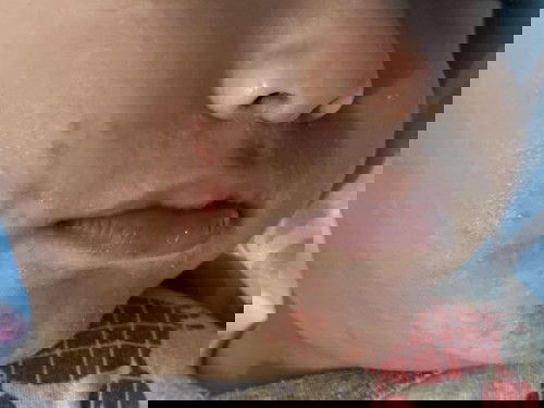 bu ibu pipi dagu anak saya merah begini kenapa ya?