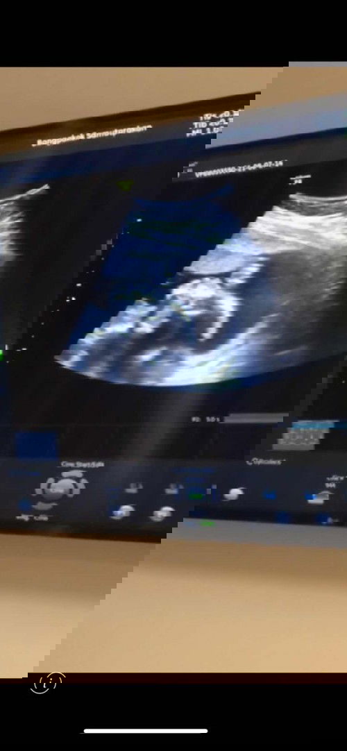 แชร์ประสบการณ์ท้องแรกจ้า