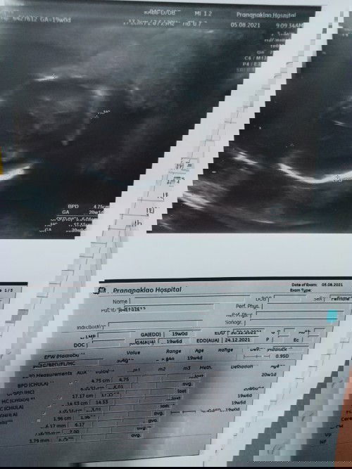 หมอบอกว่าไปทางผชมากกว่าค่ะ