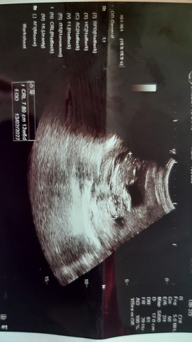 Usia kehamilan berbeda dengan Aplikasi