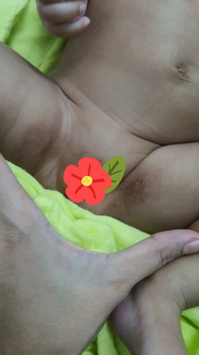 Bayi 2 bulan 18hari