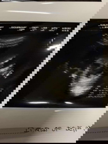 ครั้งแรกทีไปอัลตราซาวด์ 😂