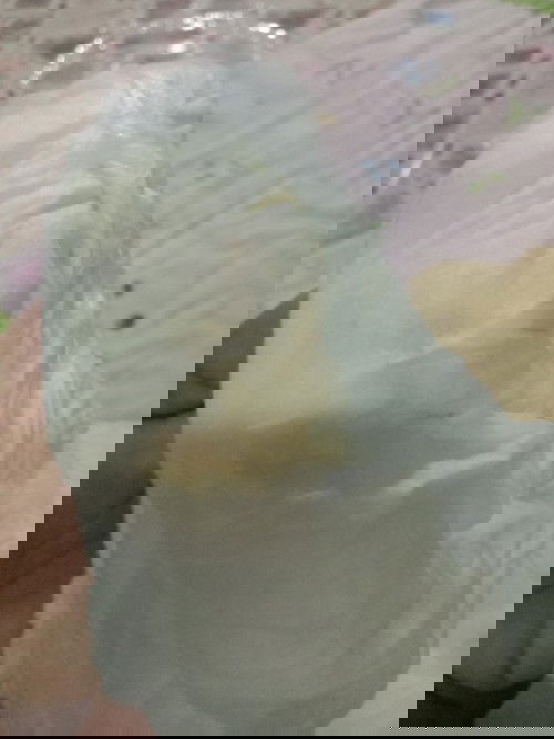 ฉีแบบนี้ออกสีแปลกๆไม่รู้ว่าเลือดหรือป่าว