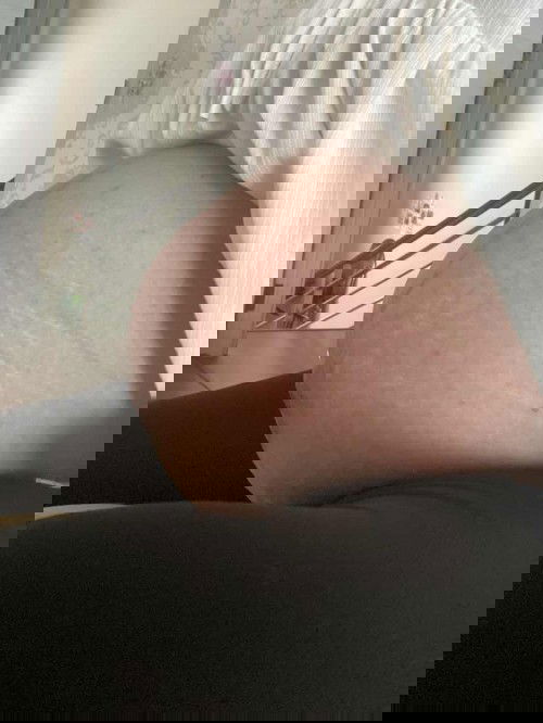 ผ่าคลอด ทำหมันเลยดีมั้ยคะ