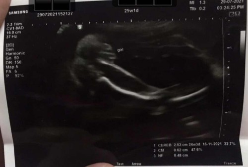 Confirm an jantina ( gamba scan )