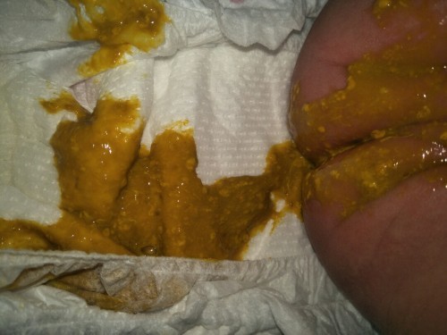 baby's poop