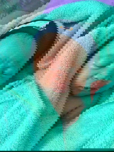 แตกแล้วจ้า41w👶🏻💕