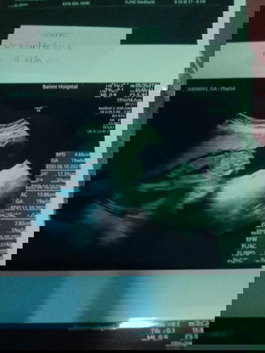 ยังไม่รู้เพศ