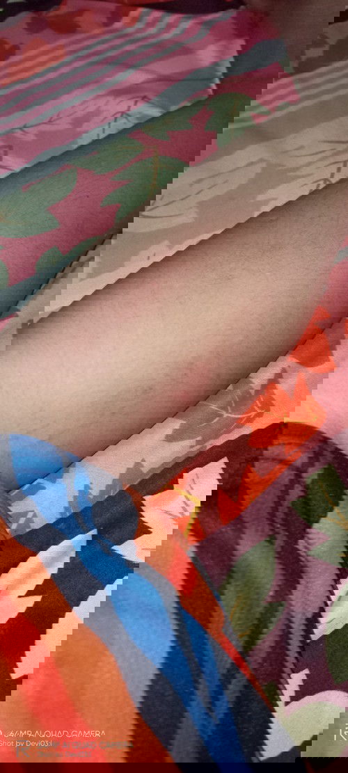 Kaki sebelah kiri pegell wajar gk si bund?
Brasa pegell nya selalu d mlam hari

#hamilMuda14week....