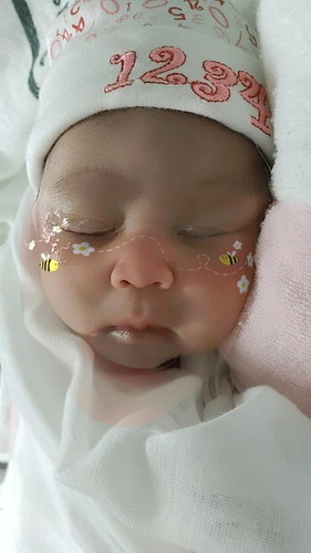 กำหนด 16/8/64
แต่คลอด08/8/64 GA 38+6wks ปลอดภัยทั้งแม่และลูก
น้ำหนัก 3,040