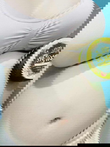 ใครหน้าท้องลาย มีเคล็ดลับแนะนำค่ะ