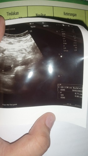 Baca usg ini gimana yah